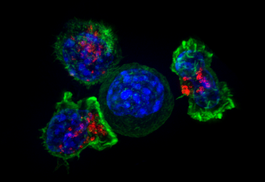 TRAITEMENT POUR GUÉRIR LES DIFFÉRENTS TYPES DE CANCER.
